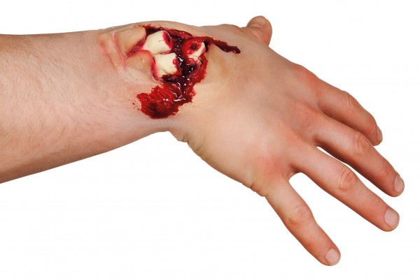 Bloody bone fracture latex application 2