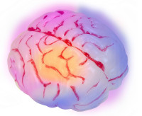 Oversigt: Blodig hjerne med farveændring