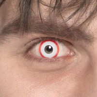 Oversigt: Skøre patient 3-måneders kontaktlinser